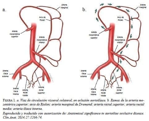 Vías de Circulación Visceral Colateral