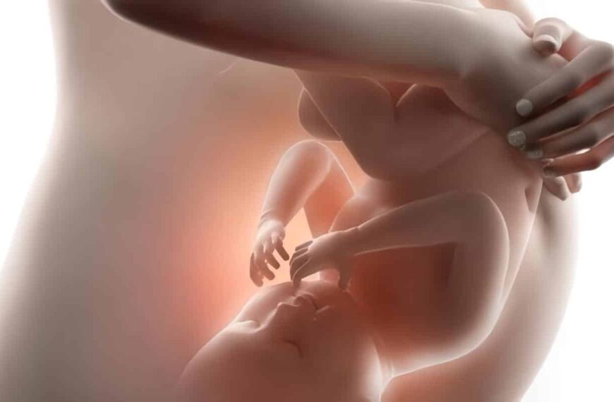 Hemorragia Obstétrica por Abrupcio de Placenta