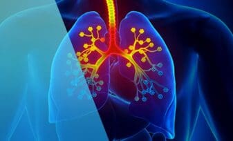 Diagnóstico de la Fibrosis Quística