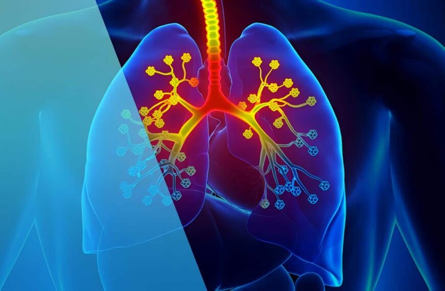 Diagnóstico de la Fibrosis Quística