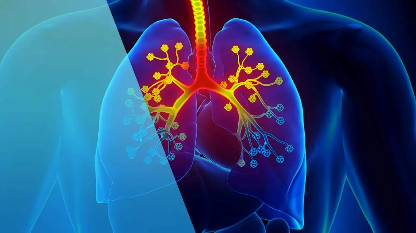 Diagnóstico de la Fibrosis Quística