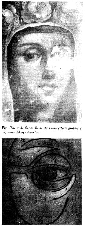 Santa Rosa de Lima (Radiografía)