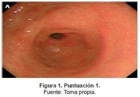 Evaluación de cuatro sitios distintos del estómago