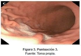 Evaluación de cuatro sitios distintos del estómago