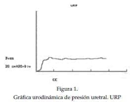 Gráfica urodinámica de presión uretral