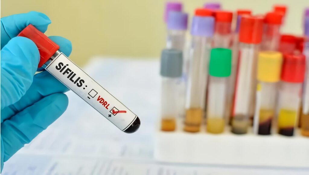 Manejo de la reinfección en mujeres con sífilis gestacional