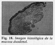 Mucosa duodenal