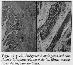 Fibras musculares del esfínter de Oddi