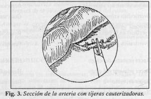 Sección de la arteria