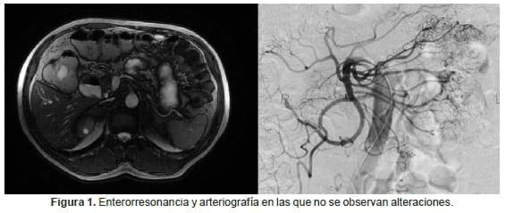 Enterorresonancia y arteriografía