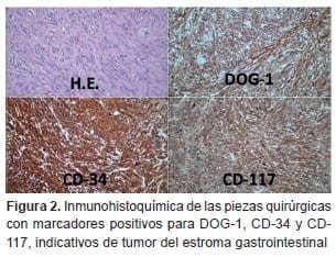 Indicativos de tumor del estroma gastrointestinal, Inmunohistoquímica