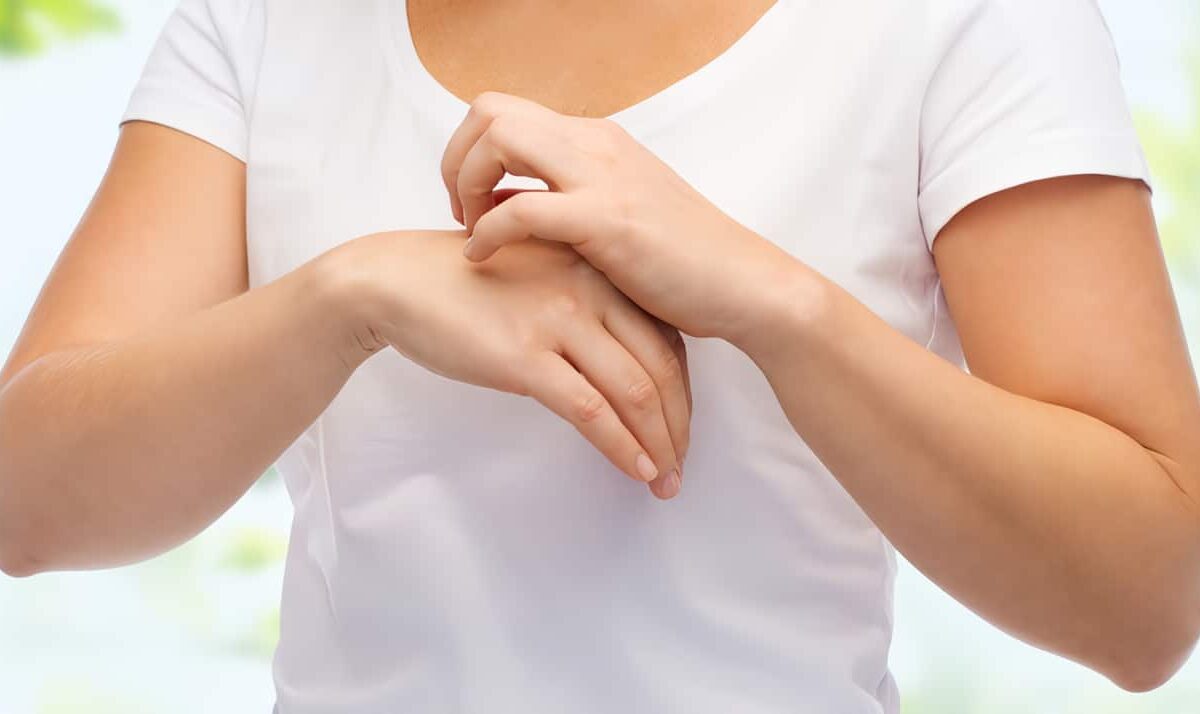 Dermatitis Atópica