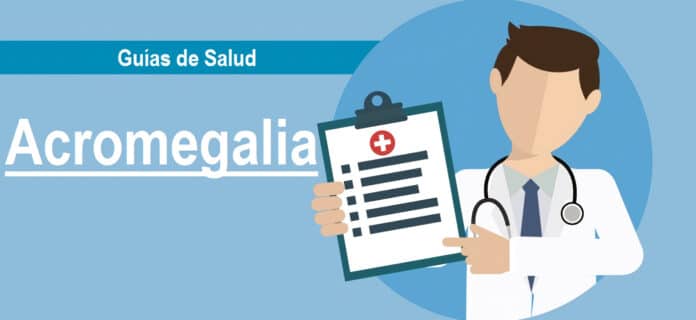 Acromegalia, Guía de Salud