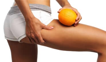 Alimentos que Ayudan a Reducir la Celulitis