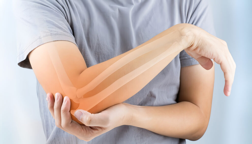 Cáncer de Huesos
