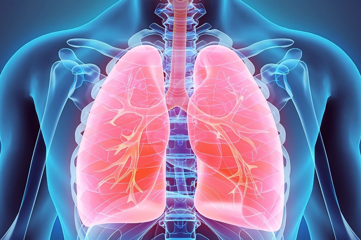 Tromboembolia Pulmonar, Guía de Salud