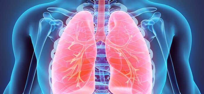 Tromboembolia Pulmonar, Guía de Salud