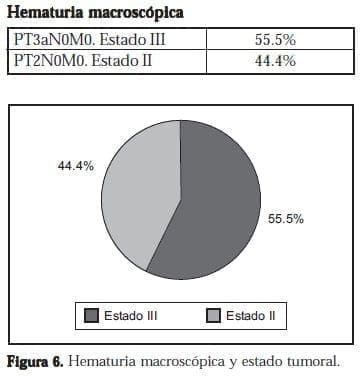 Hematuria macroscópica y estado tumoral