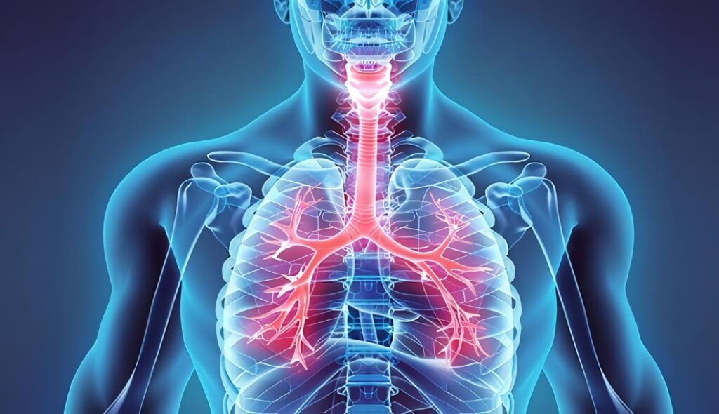 Lesiones Pulmonares Traumáticas