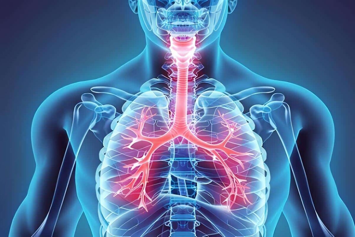 Lesiones Pulmonares Traumáticas