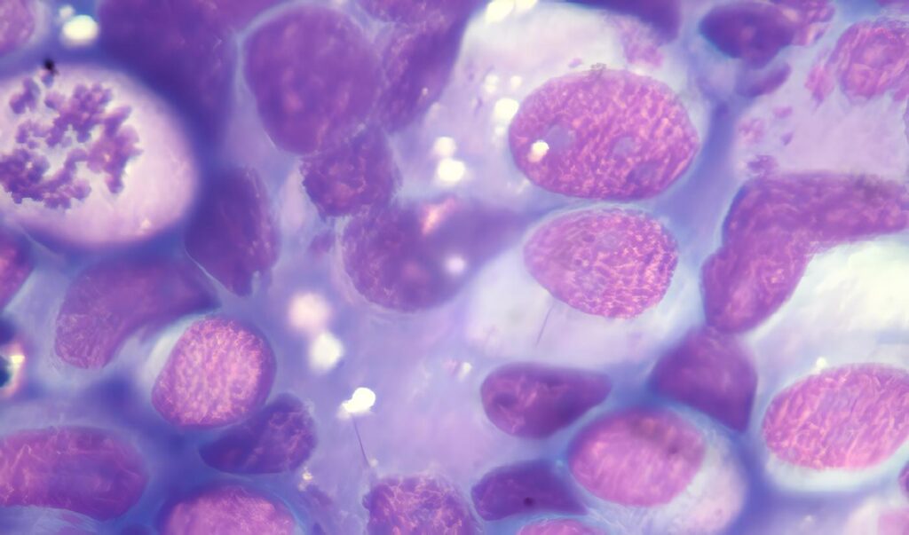 Reporte de Caso: Seminoma Gigante