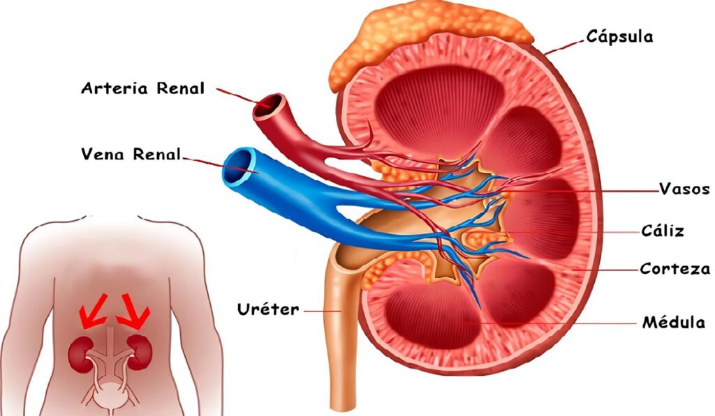 Trombosis Arteria Renal