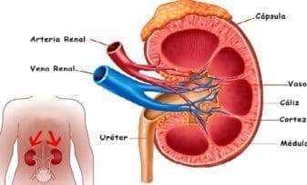 Trombosis Arteria Renal
