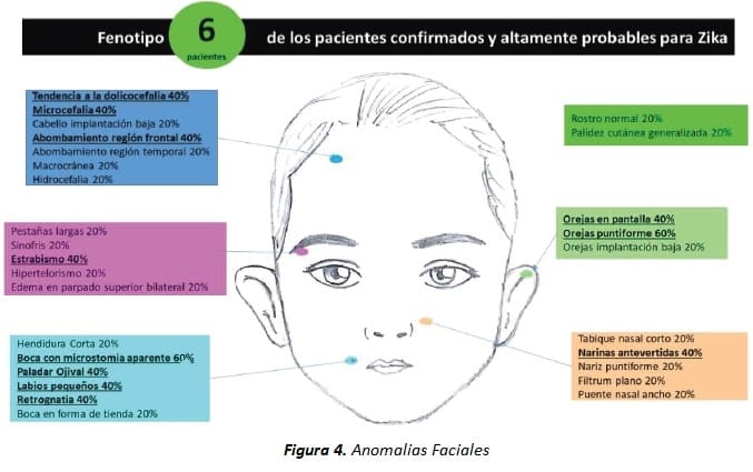 Anomalías Faciales, Fenotipo de Pacientes con Zika
