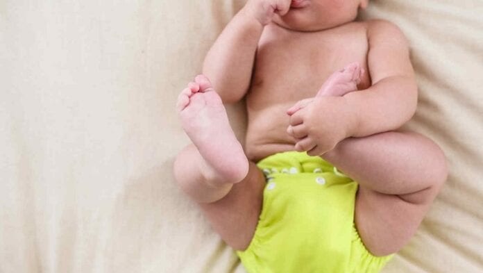 Displasia de Cadera en Bebés