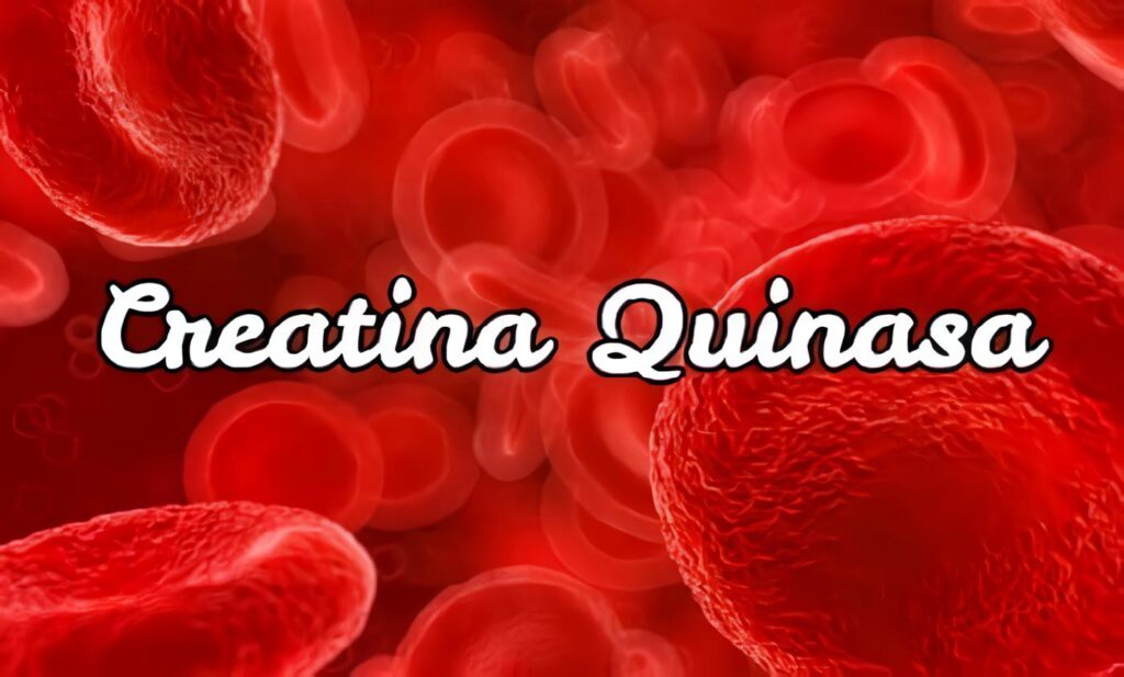 Creatina Quinasa