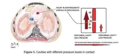 Cavities with different pressure levels in contact