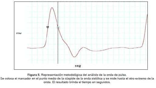 Representación metodológica del análisis de la onda de pulso