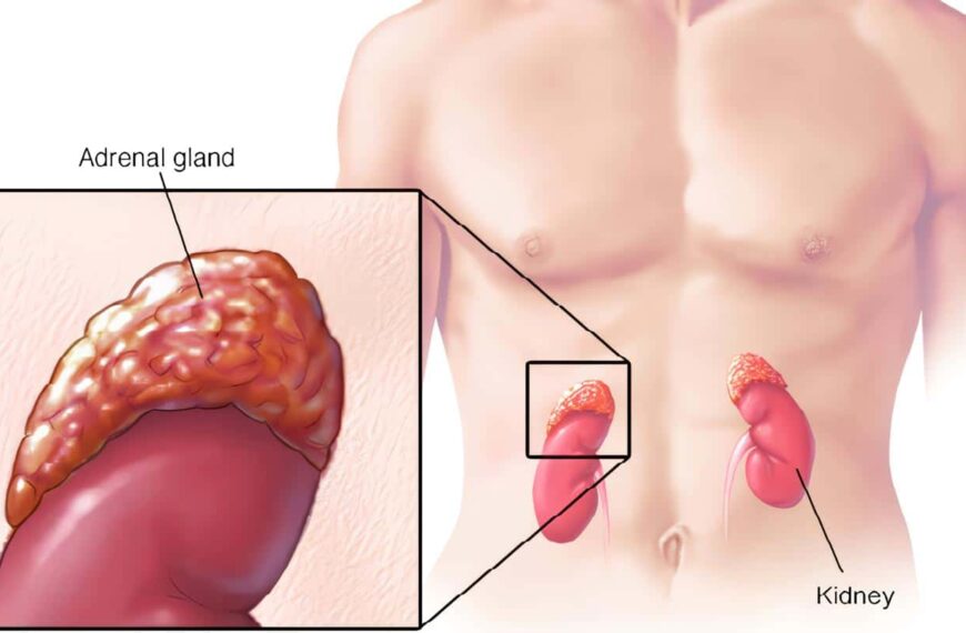 Glándula Adrenal