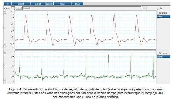 Representación metodológica del registro de la onda de pulso y electrocardiograma