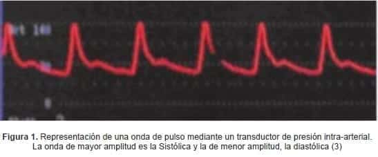Representación de una onda de pulso mediante un transductor de presión intra-arterial.