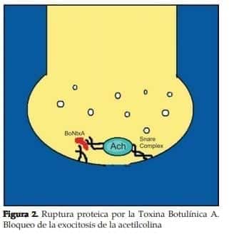Ruptura proteica por la Toxina Botulínica