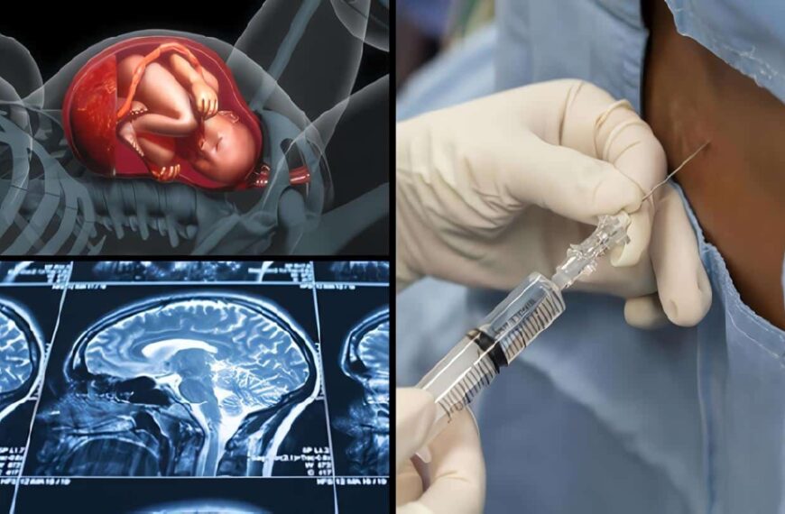 Anestesia Neuroaxial