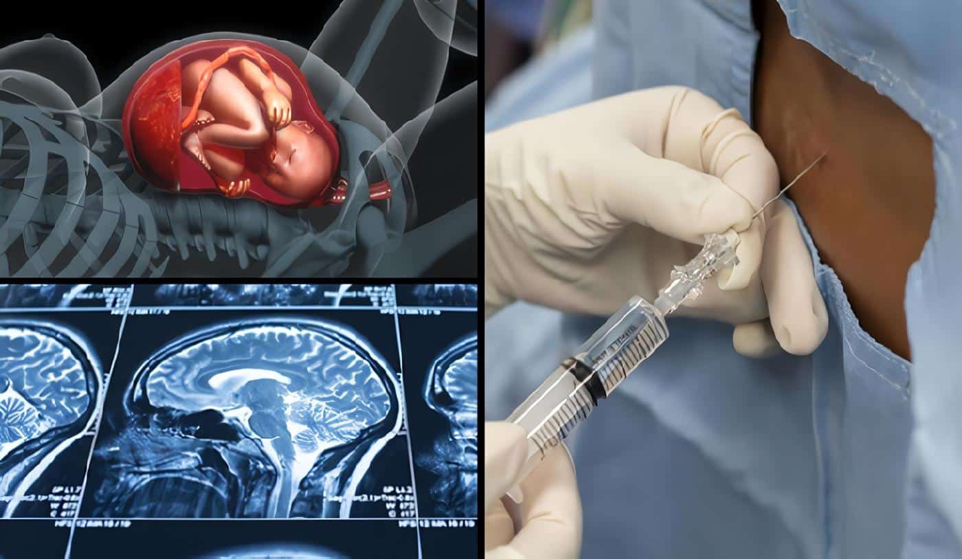 Anestesia Neuroaxial