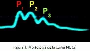 Morfología de la curva de PIC