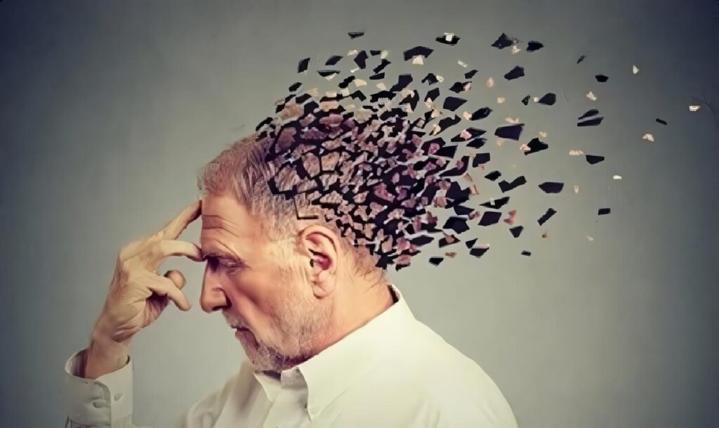Remedios Caseros para el Alzheimer