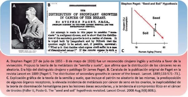 Steven Paget propuso la teoría sobre el cáncer como “semilla y tierra”