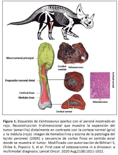 Esqueleto de Centrosaurus apertus con el peroné mostrado en 