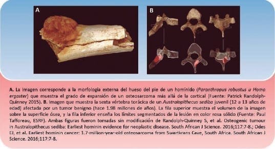 Morfología Externa del hueso del Pie de un Homínido