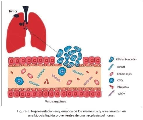 Biopsia líquida provenientes de una neoplasia pulmonar