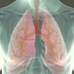 Guía para Fibrosis Quística