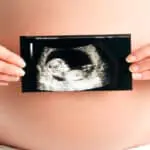 Guía Práctica en Diagnóstico Prenatal