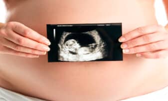 Guía Práctica en Diagnóstico Prenatal