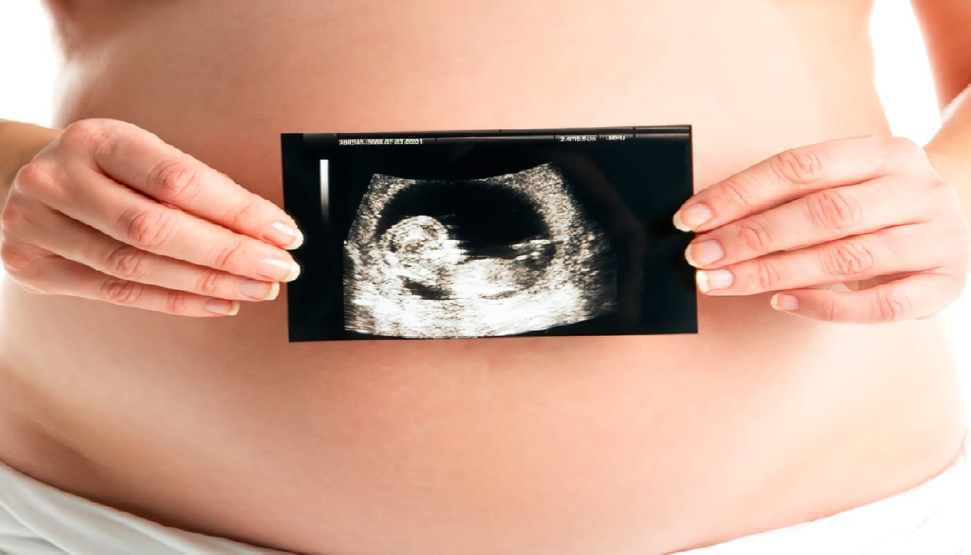 Guía Práctica en Diagnóstico Prenatal