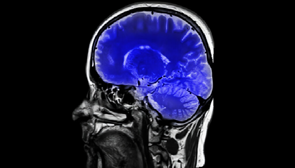 Manual de procedimientos en Neurocirugía