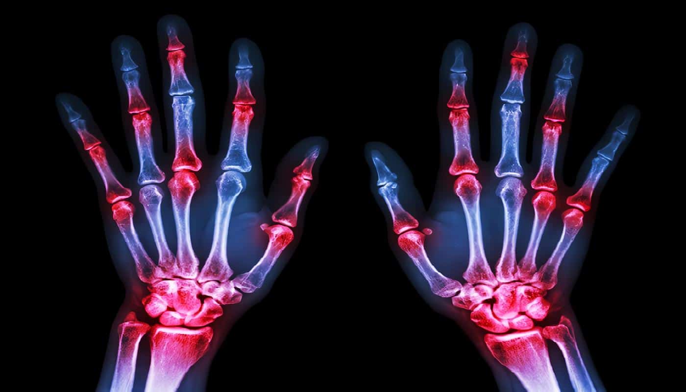 Revista Colombiana de Reumatología